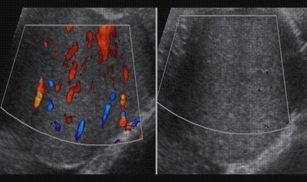 ᐉ 14 Mejores Ecos Doppler Testicular Precios Y