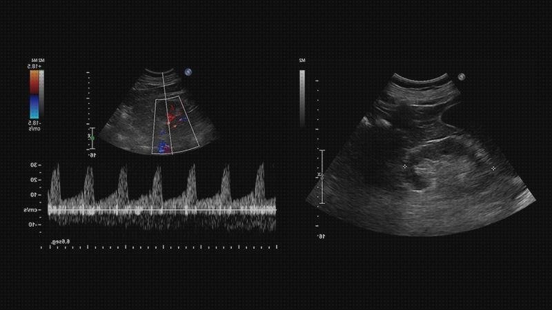 Las mejores marcas de ecografía doppler accesorios en ecografía doppler