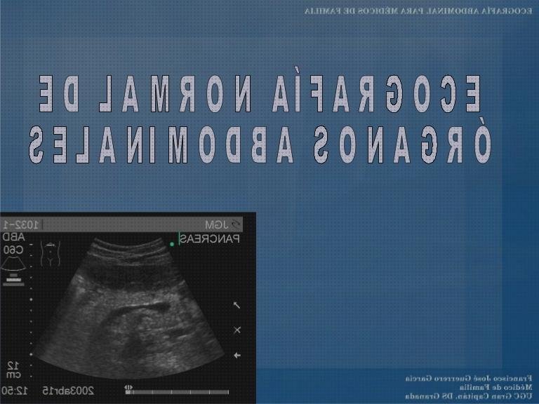 Las mejores ecografica anatomia ecografica de abdomen