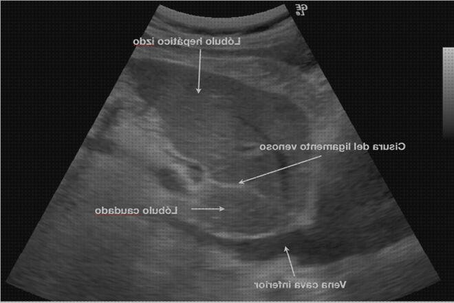 ¿Dónde poder comprar ecografica division ecografica del higado?