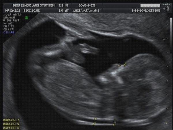 ¿Dónde poder comprar doppler obstetrico?