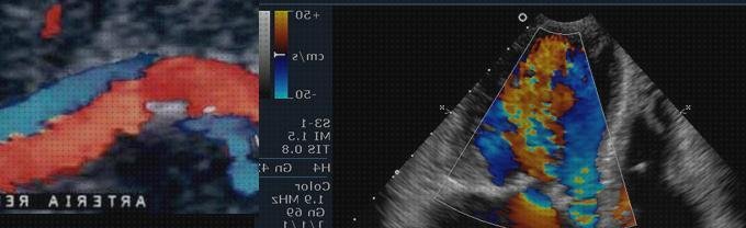 Los 18 Mejores Ecos Doppler De Penes