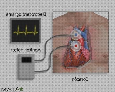 ¿Dónde poder comprar doppler eco doppler medlineplus?