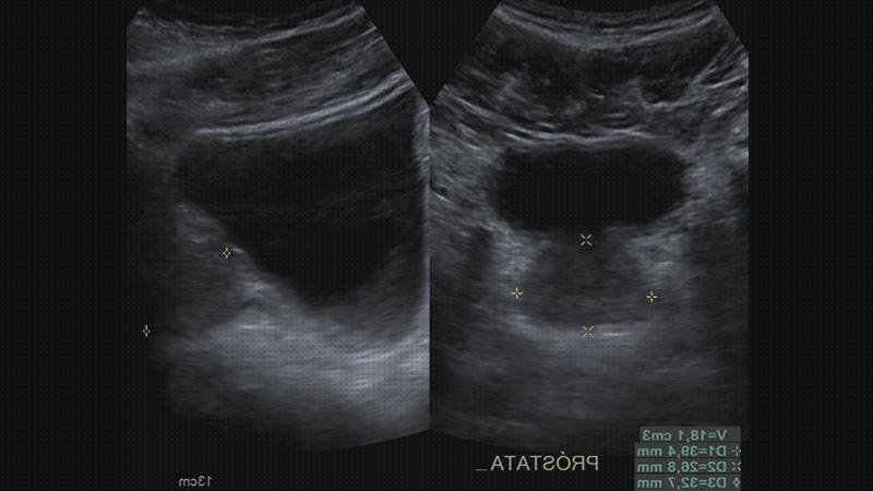 Opiniones de las 13 mejores Ecografías Abdómenes Y Pelvis