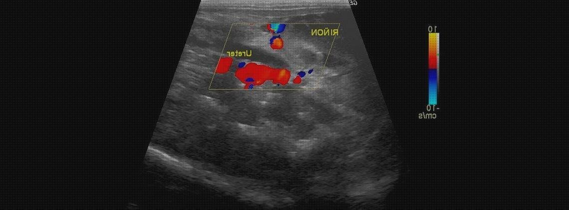 ¿Dónde poder comprar ecografia eco doppler ecografía doppler ecografía con doppler color?