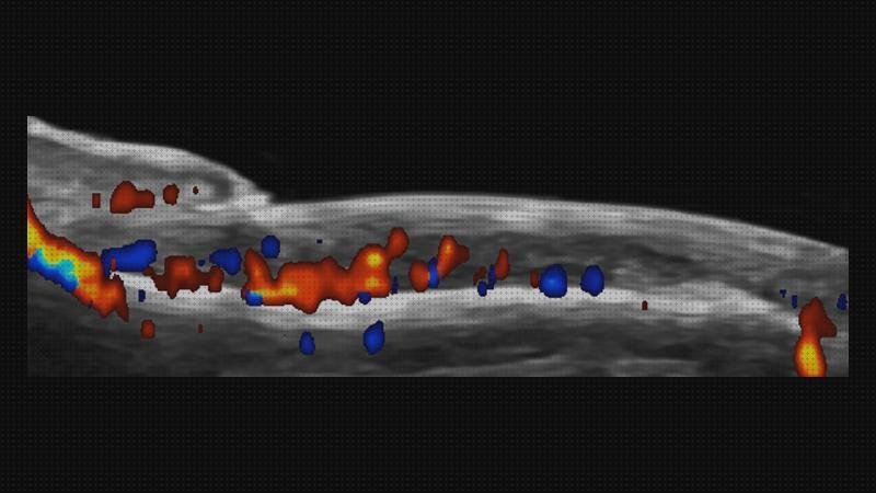 Las 15 Mejores Ecografías Con Doppler Colores