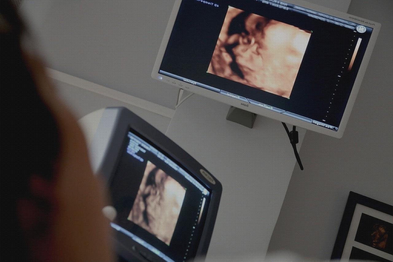 Las mejores ecografía corazón preparación Mas ecografía coneja ecografías ecografía corazón aorta