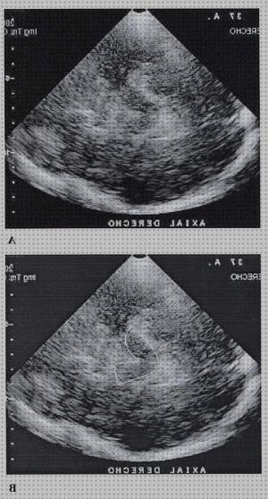 ¿Dónde poder comprar Mas ecografía coneja ecografías ecografía craneal adulto?