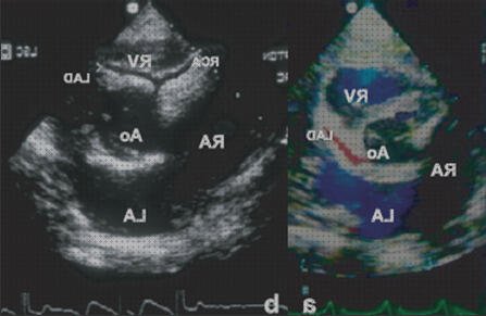 ¿Dónde poder comprar arterias ecografía de lad arterias?