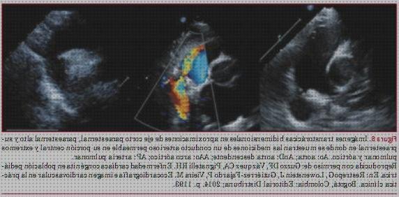 Opiniones de las 8 mejores Ecografías De Lad Arterias