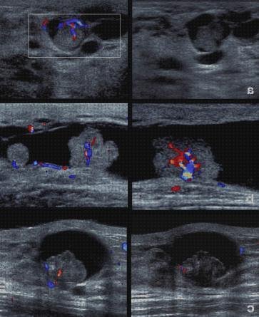 ¿Dónde poder comprar ecografias doppler ecografía doppler mama color?