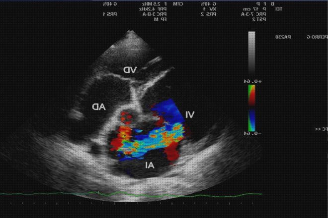 ¿Dónde poder comprar ecografias doppler ecografía doppler rojo?