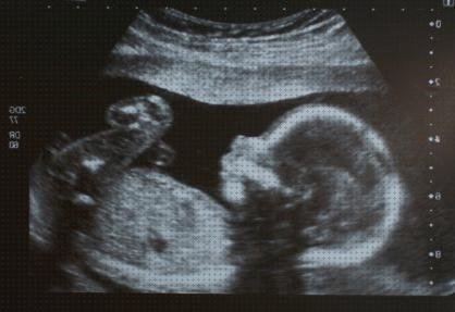 ¿Dónde poder comprar antes ecografía embarazo antes de la fecundación?