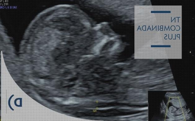 ¿Dónde poder comprar ecografía 12 semanas doppler ecografía doppler ecografía obstétrica doppler 12 semanas?