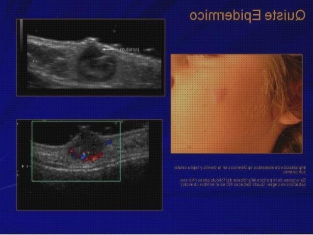 17 Mejores ecografías pieles bajo análisis