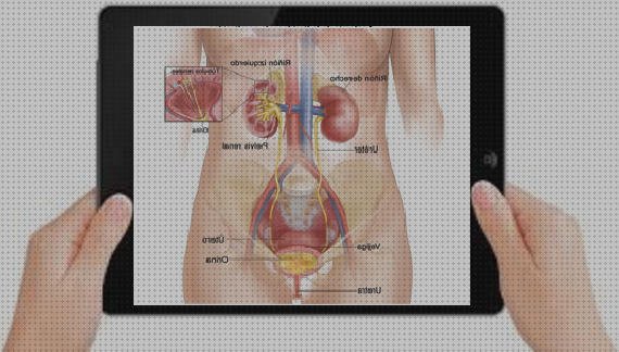 Review de ecografía renal y de vías urinarias