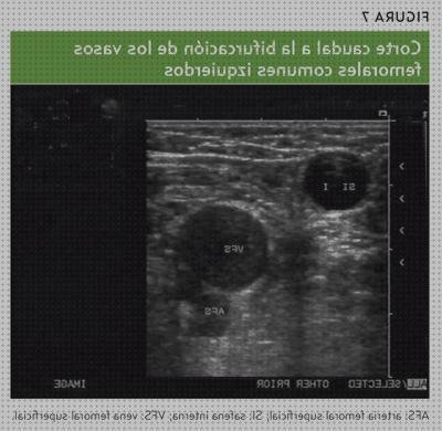 ¿Dónde poder comprar ecografía vasos popliteos?