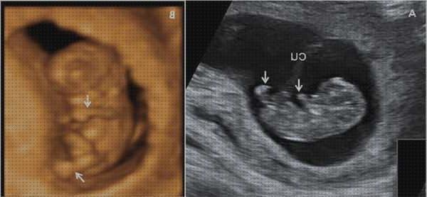 Las mejores Mas ecografía coneja ecografías ecografías por semanas