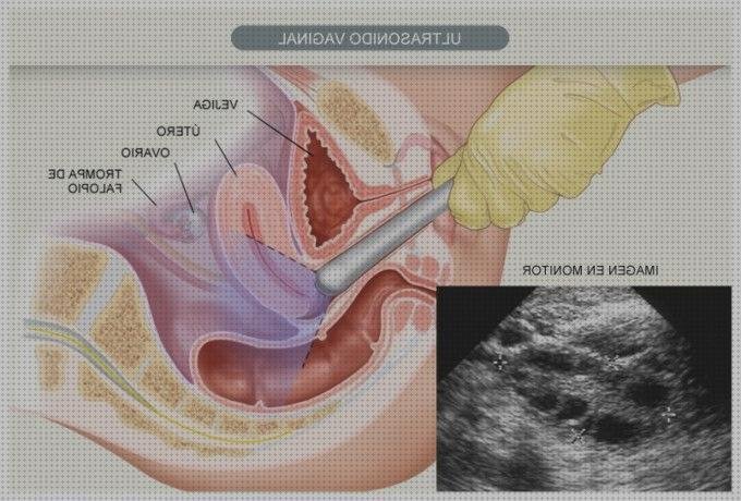 Los mejores 14 Ecografo Para Ecografias Vaginales