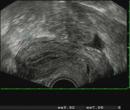 ¿Dónde poder comprar ecografias ecografos ecografo para ecografia vaginal?