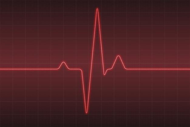 ¿Dónde poder comprar electrocardiograficos?