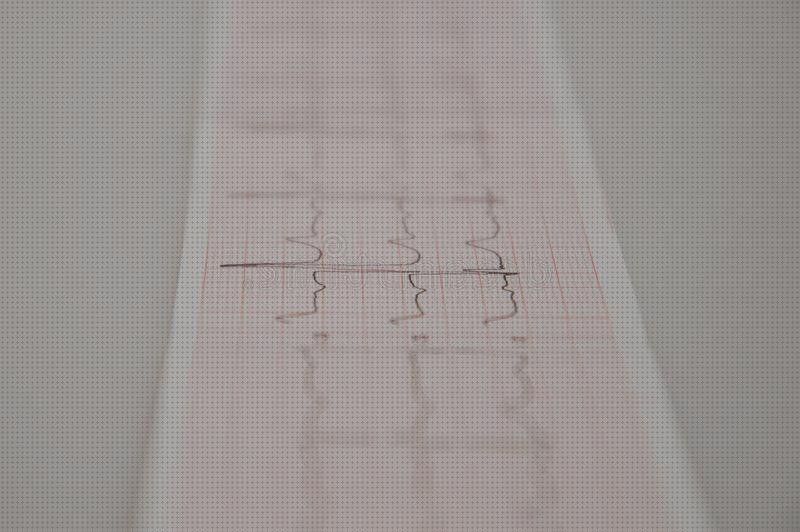Las mejores electrocardiografos electrocardiografo arritmia