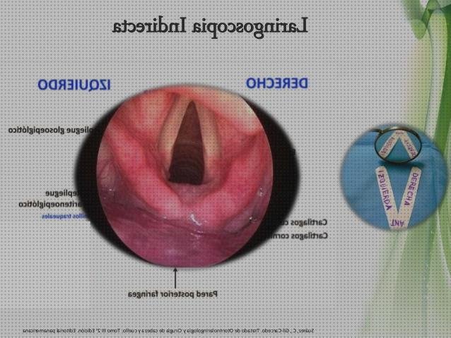 Review de los 5 mejores laringoscopia indirectas nasales a la venta