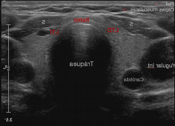 ¿Dónde poder comprar tiroiditis eco doppler?