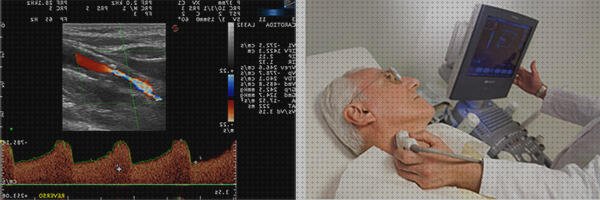 Las mejores marcas de ecografía doppler de los troncos supraaórticos Mas eco doppler transtoracico ecografía doppler troncos supraaorticos eco doppler